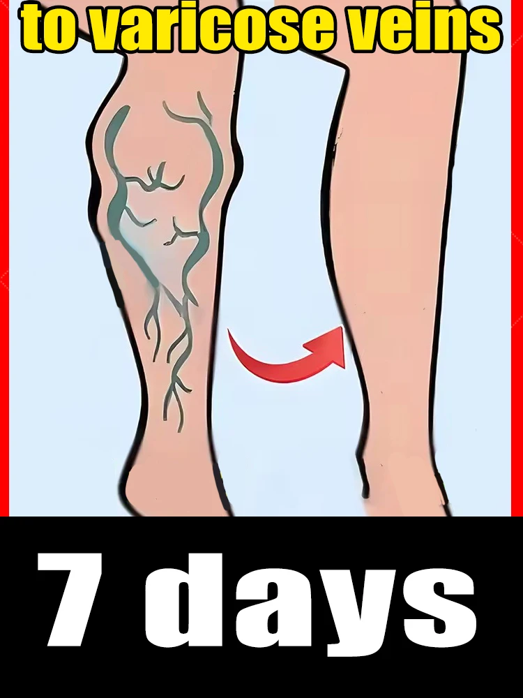 

hot sale 2025 leg care tools Say goodbye to leg discomfort Spider Legs Relieve leg pressure blue light pen solve varicose veins