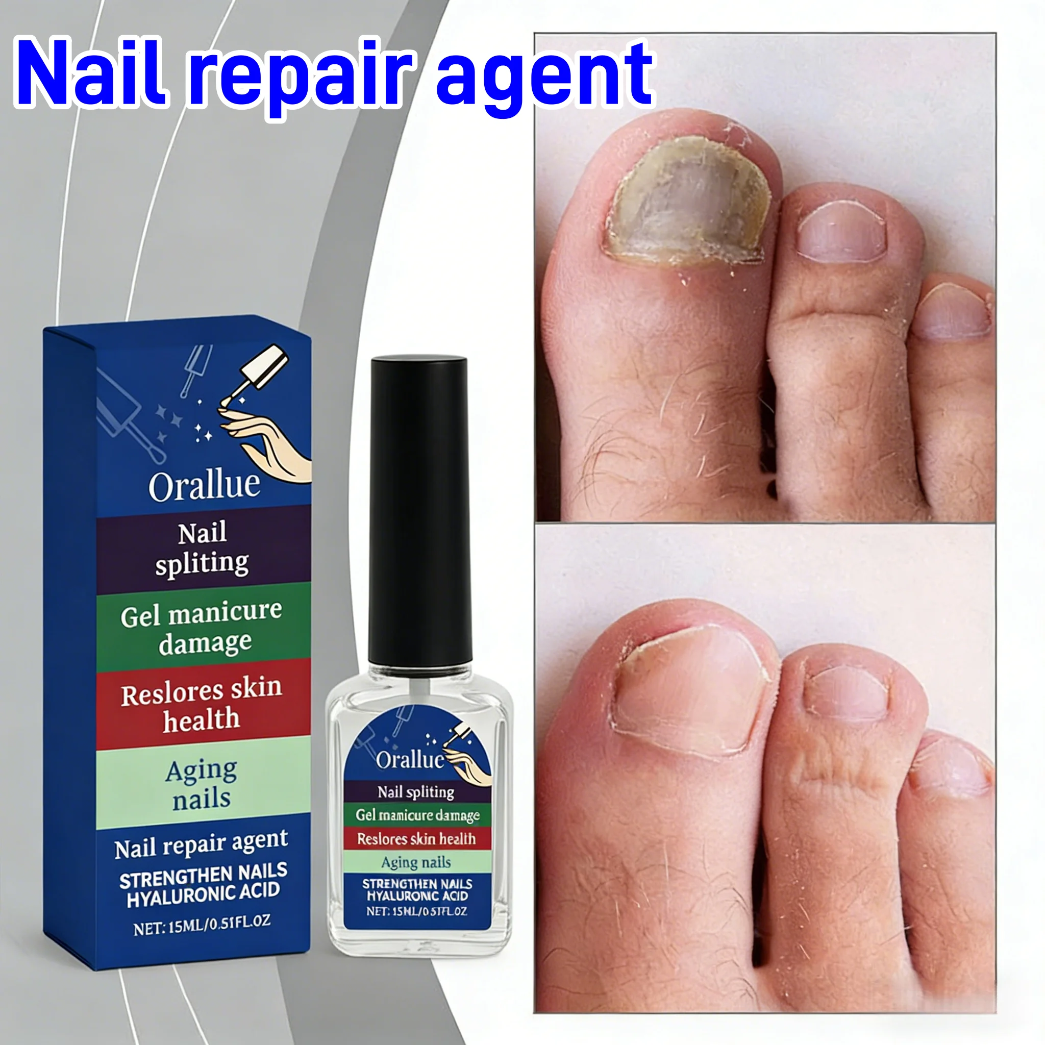 

Средство для восстановления ногтей: питание и укрепление ломких ногтей на руках и ногах, против ломкости, для роста и укрепления, усилитель для сухих и ломких ногтей.