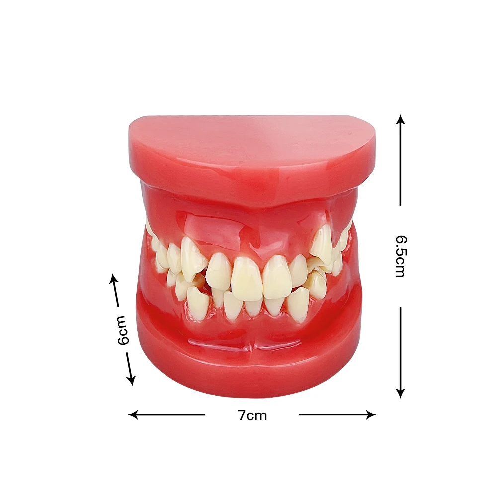 Dental Teeth Model Dental Teeth Malocclusion Model Practice Teaching Training Communication Model Oral Medical Tooth Models