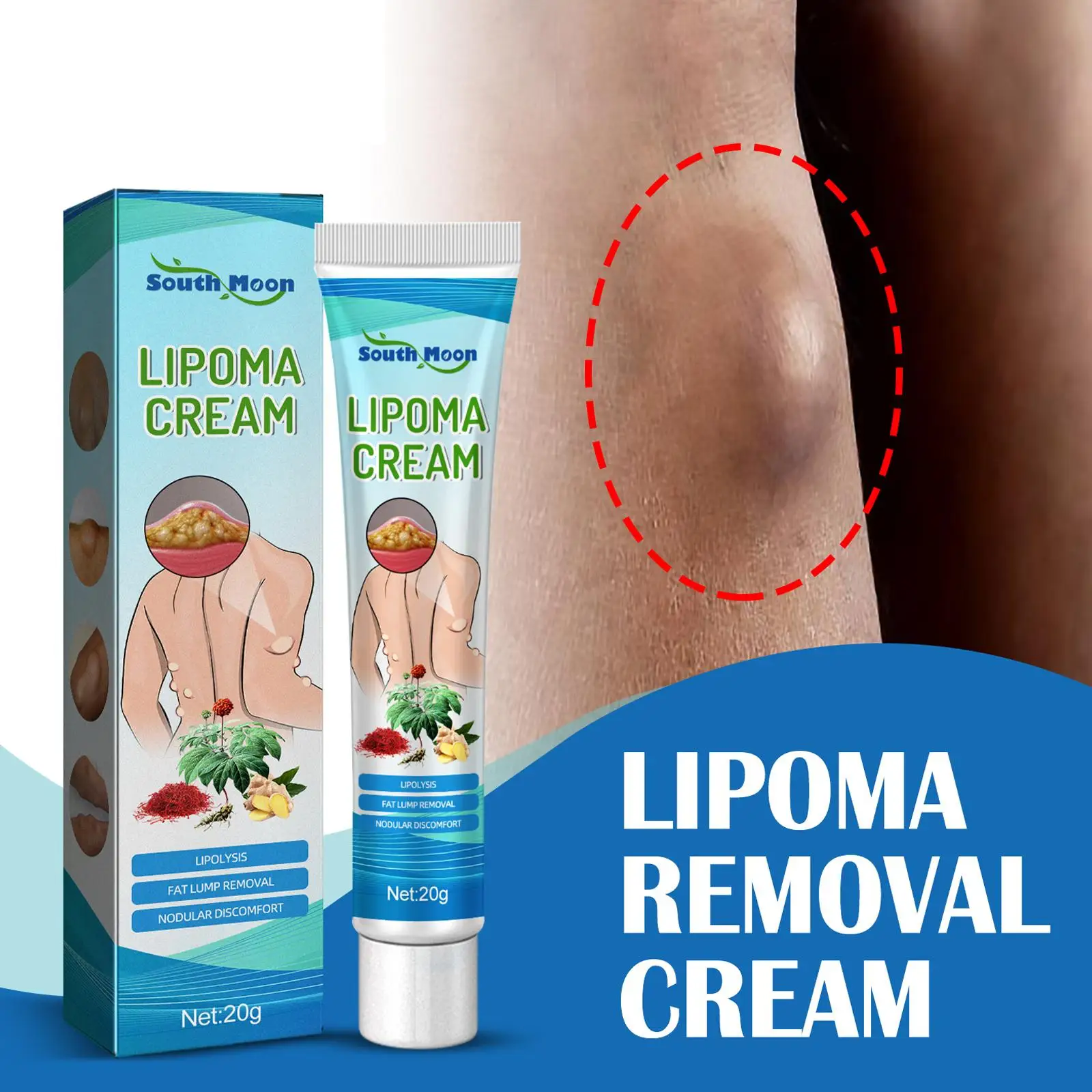 3/5 sztuk krem do usuwania lipomów lipoliza ulga w stomach tłuszczu plaster obrzęk skóry krem do eliminacji tłuszczu darmowa wysyłka 20g opieka zdrowotna