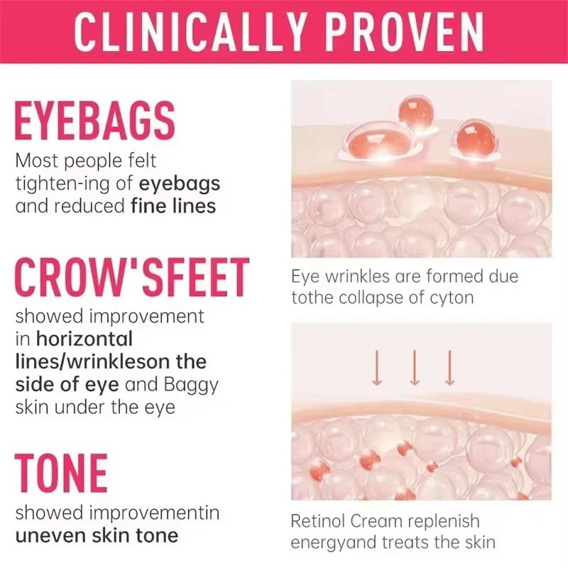 인스턴트 아이 백 제거 크림 콜라겐 안티 링클 퍼밍 스킨 페이드 파인 라인 안티 다크 서클 붓기 밝게 아이 케어