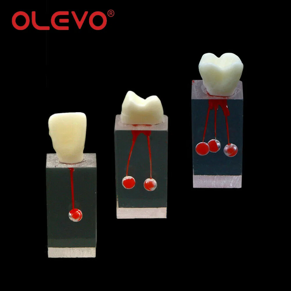 OLEVO-modelo de dientes de Canal radicular, bloque de práctica de cavidad de pulpa RCT, entrenamiento de endodoncia, modelos de enseñanza de dentista, 1 piezas