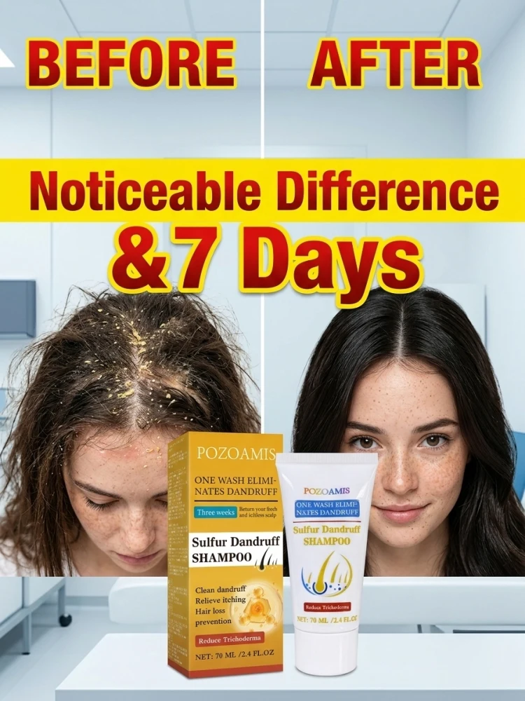 Gentle Sulfur Cleansing Shampoo, Optimize Scalp Surface Condition, Minimize Dandruff Look, Calm Uncomfortable Scalp, Boost Hair Root Toughness, Improve Broken‑Hair & Shedding Visual Effect for Men Women Daily Home Hair Beauty Care