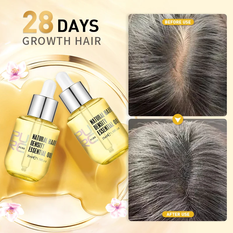 

Hair Growth Serum Ginger Extract Prevent Hair Loss Oil Scalp Treatments Fast Growing Hair Care Products for Women 35ml