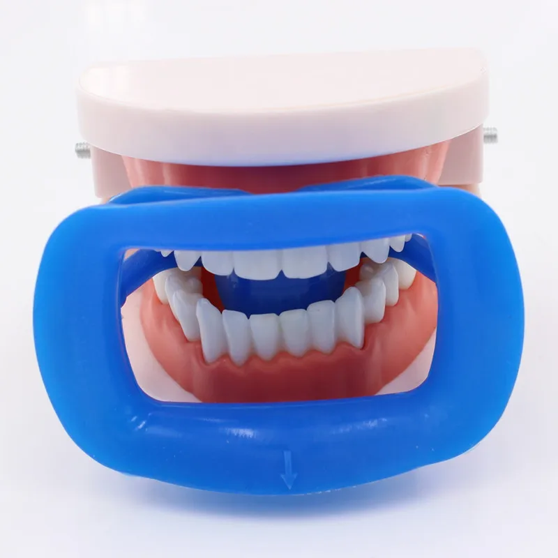 Écarteur dentaire en silicone souple autoclavable, outils orthodontiques, ouvre-bouche intra-Chev, extension de joue, Jules