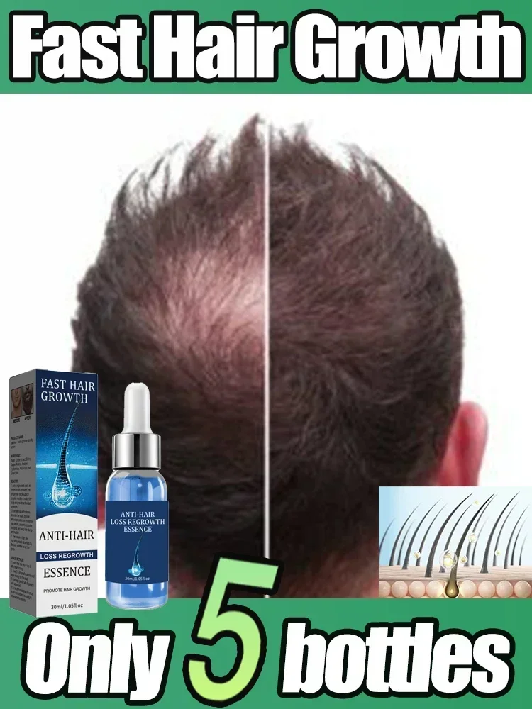 

Hair Growth Essential Loss Regrowth Treatment Strengthens Hair Nourishes Scalp Light Weight Non Greasy Improve Scalp Circulation