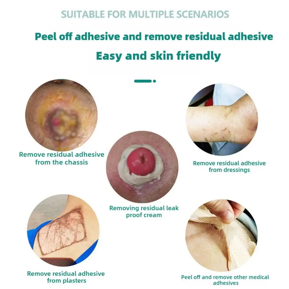 3 زجاجات فغر القولون لاصق مسح قبالة رذاذ الطبية مزيل لاصق كيس الفغرة الرعاية تنظيف وتطهير لوازم الجلد