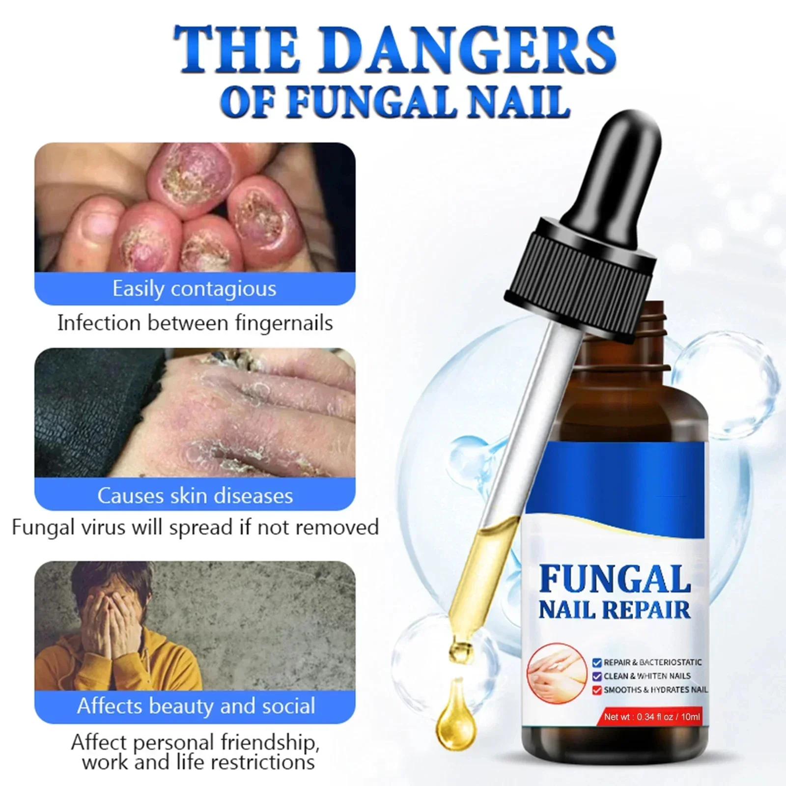 ⁿⁱᶜᵉ Toenail Nail Fungus Treatment Repair Fingernail Device Toenail Treatment for Foot Nail Fungus Essential Oil Onychomycosis C