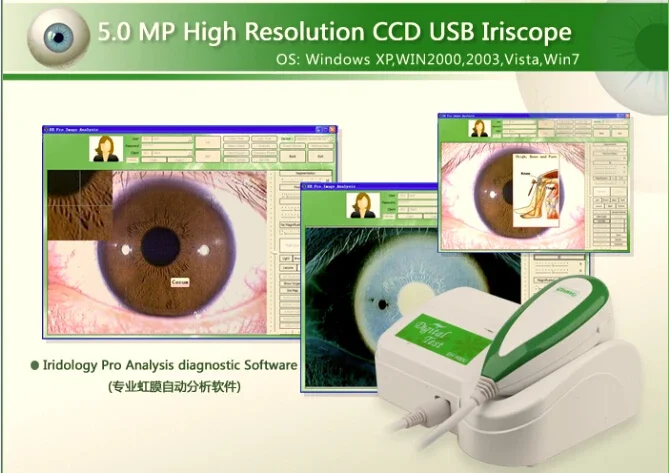 Aluminum case package English software 5.0 MP high resolution USB iriscope scanner iridology