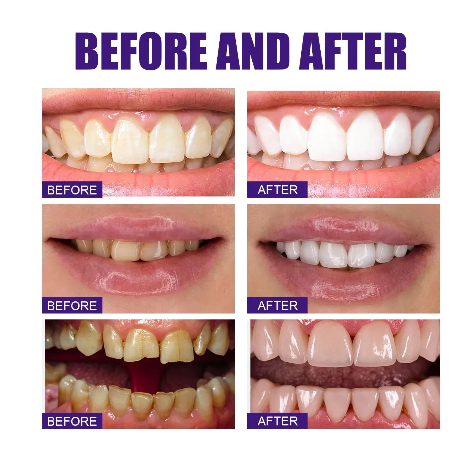 Sensitive Toothpaste with V34 Purple Formula for Oral Odor and Stains Removal Teeth Whitening V34 Colour Corrector Teeth