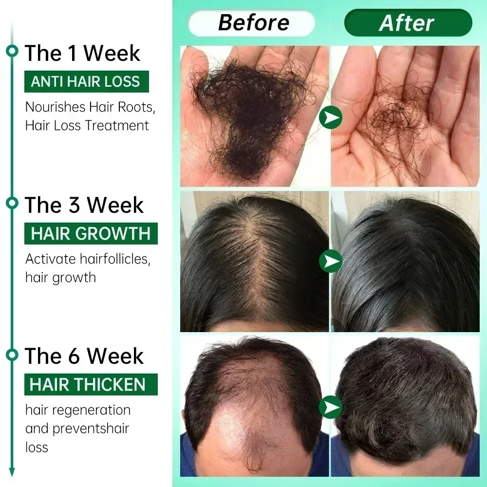 Hair Growth Essential Loss Regrowth Treatment Strengthens Hair Nourishes Scalp Light Weight Non Greasy Improve Scalp Circulation