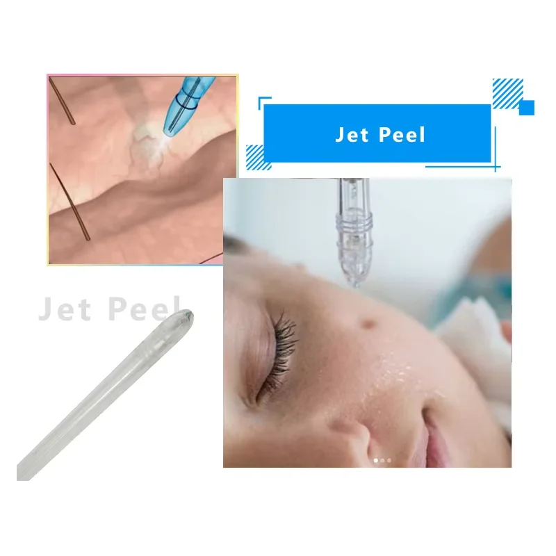 Dropshipping limpieza Facial Jet Peel tratamiento del acné agua oxígeno Spray oxígeno cuidado de la piel rejuvenecimiento de la piel máquina de pistola pulverizadora