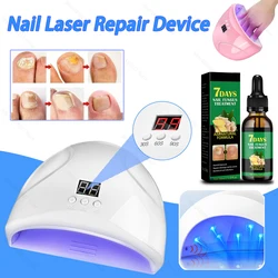 Nail Fungus Laser Treatment Device Repair Toenail Fingernail Fungus Treat Onychomycosis Laser Nails With Mushrooms Remove