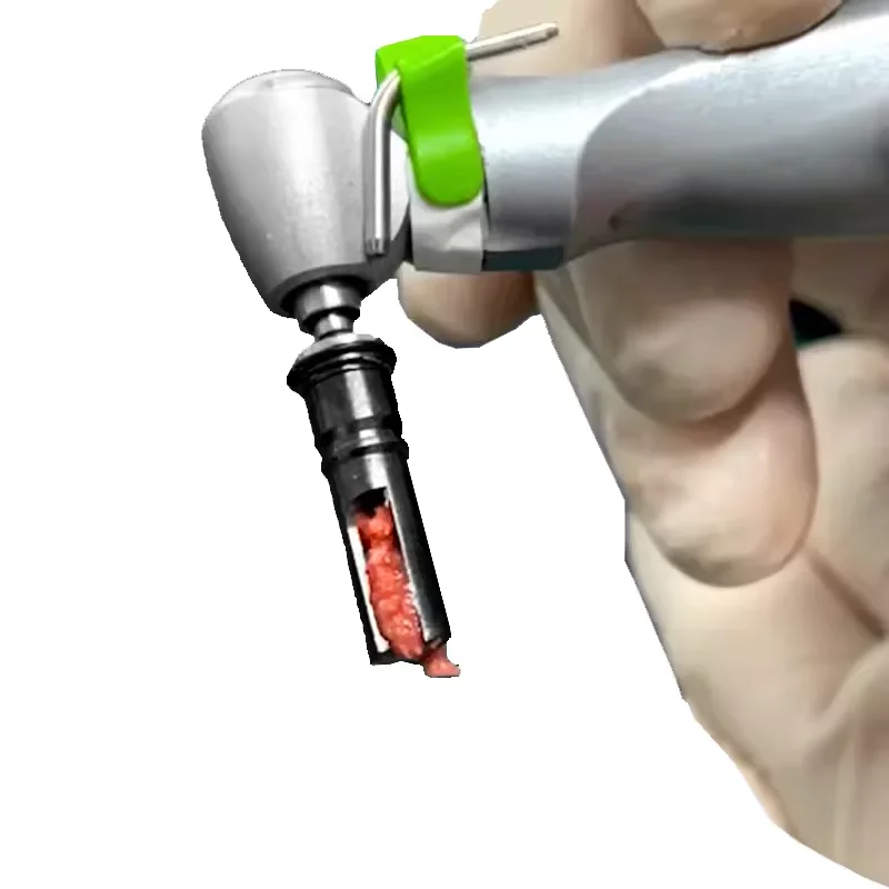 3 Types Dental Implant Bone Extraction Drill Self Grinding Bone Powder Collection Drill Positioning Spring Device Outer Cover