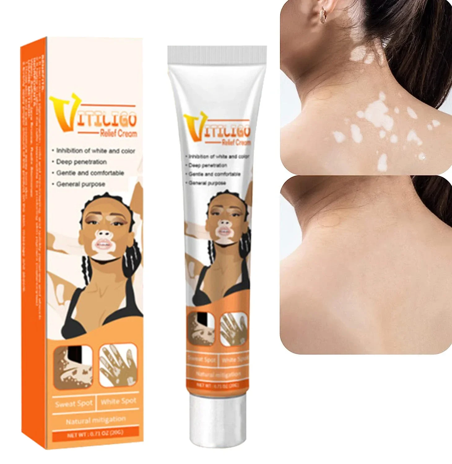 

Vitiligo Treatment for Skin Vitiligo, Vitiligo Care Cream for Reduce White Spots and Improve Skin Pigmentation