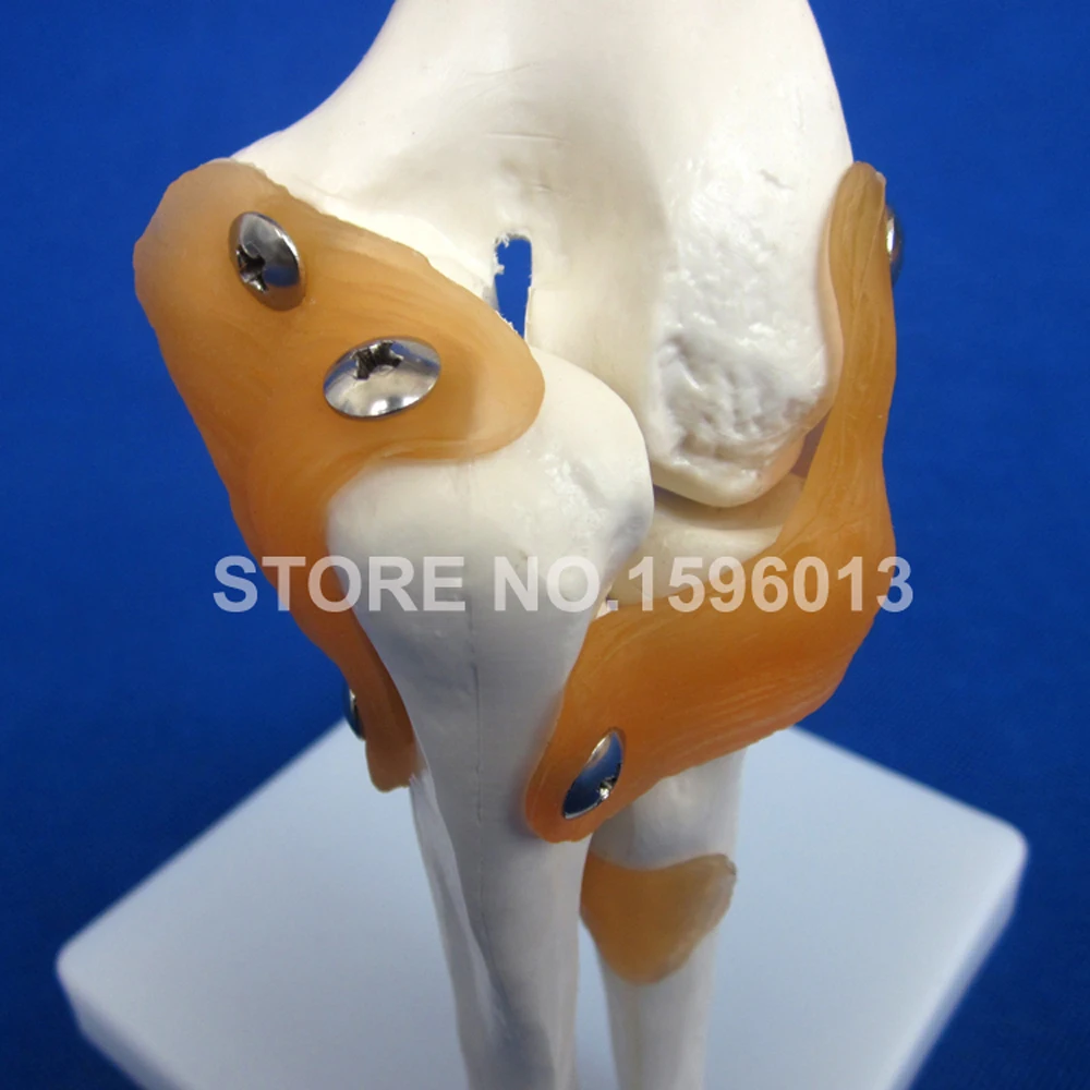 HOT Life-Size Elbow Joint Model, Bone with Ligament Anatomical Teaching Demonstration Simulator