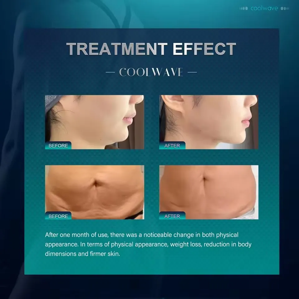 

VIP Shipping / customs charges supplement