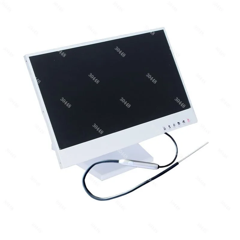 

HD Visual Ear Cleaning Endoscope 2mm Lens ENT Inspection Nasal Viewing 15.6-inch Screen Waterproof Oilproof