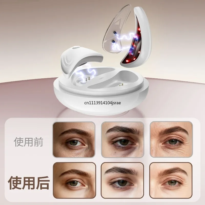 EMS Micro‑Current Red Light Eye Massager, Portable Eye Beauty Device to Remove Dark Circles, Puffiness and Eye Bags