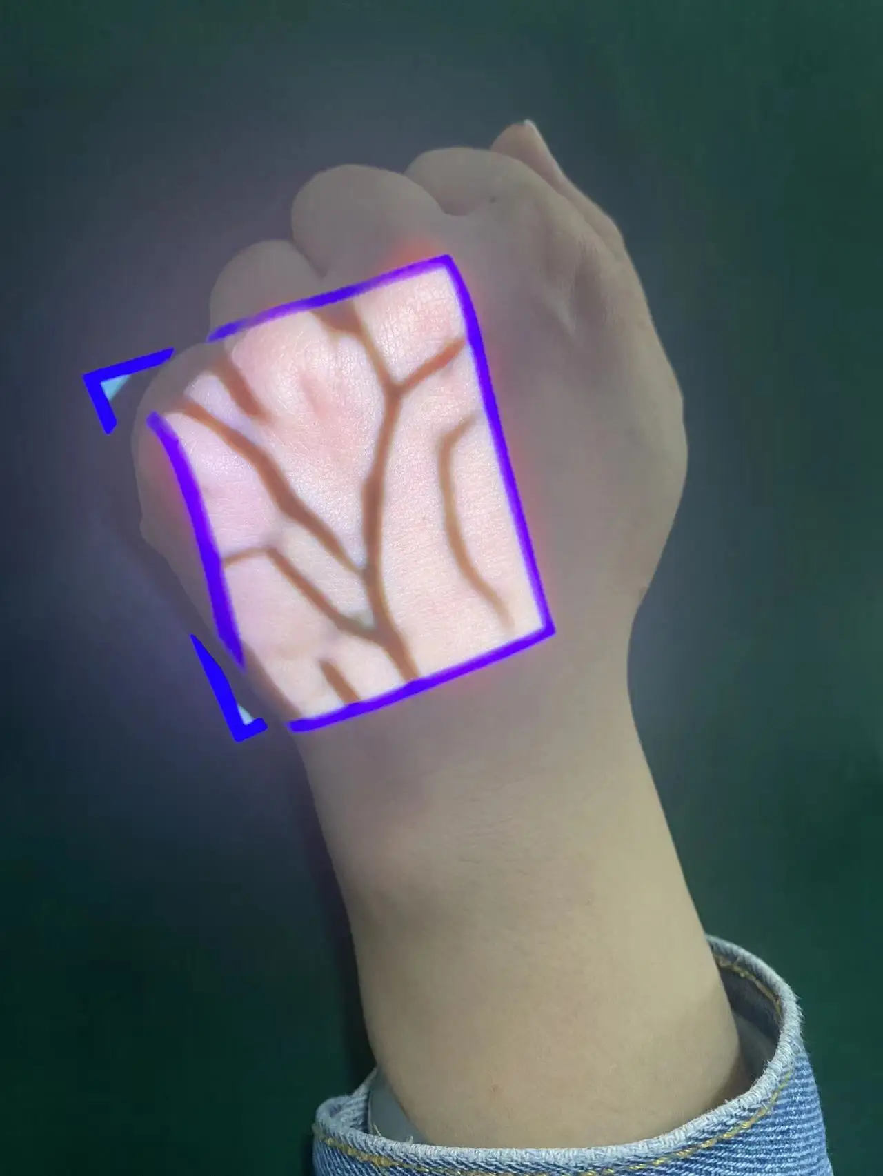 thumb