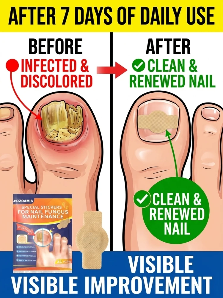 

Wᴀᴛᴇʀᴘʀᴏᴏғ Fᴜɴɢᴀʟ Nᴀɪʟ Pᴀᴛᴄʜᴇs: Rᴇᴘᴀɪʀ ᴀɴᴅ Cᴀʀᴇ ғᴏʀ Dᴀᴍᴀɢᴇᴅ Nᴀɪʟs