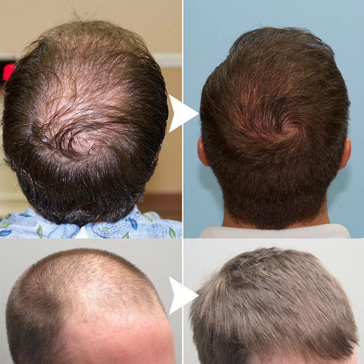 7 Days Ginger Hair Growth Spray Oil Men Women Fast Promote Hair Grow Thicker Anti Hair Loss Scalp Treatment Nourish Hair