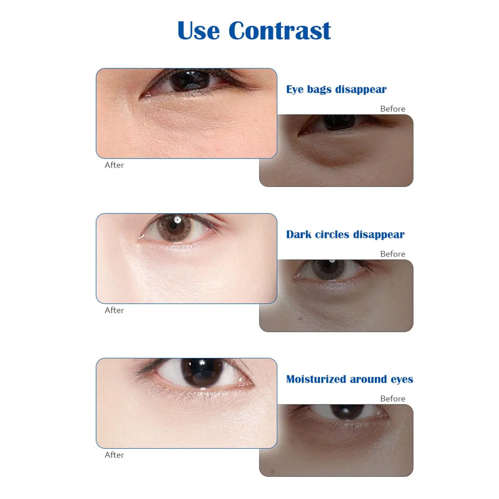 피로 완화, 깊은 휴식 및 부종 제거를 위한 쿨링 아이 패치 10쌍 상쾌하고 진정시키는 수면 보조제