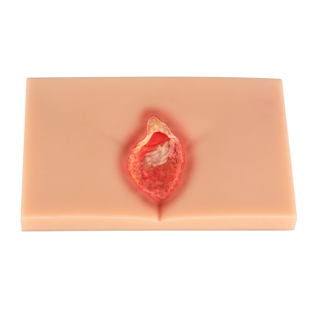 زخم ضغط السيليكون (المرحلة 1-4) نموذج تمريض مظاهرة، محاكي السيليكون، نموذج للتدريس