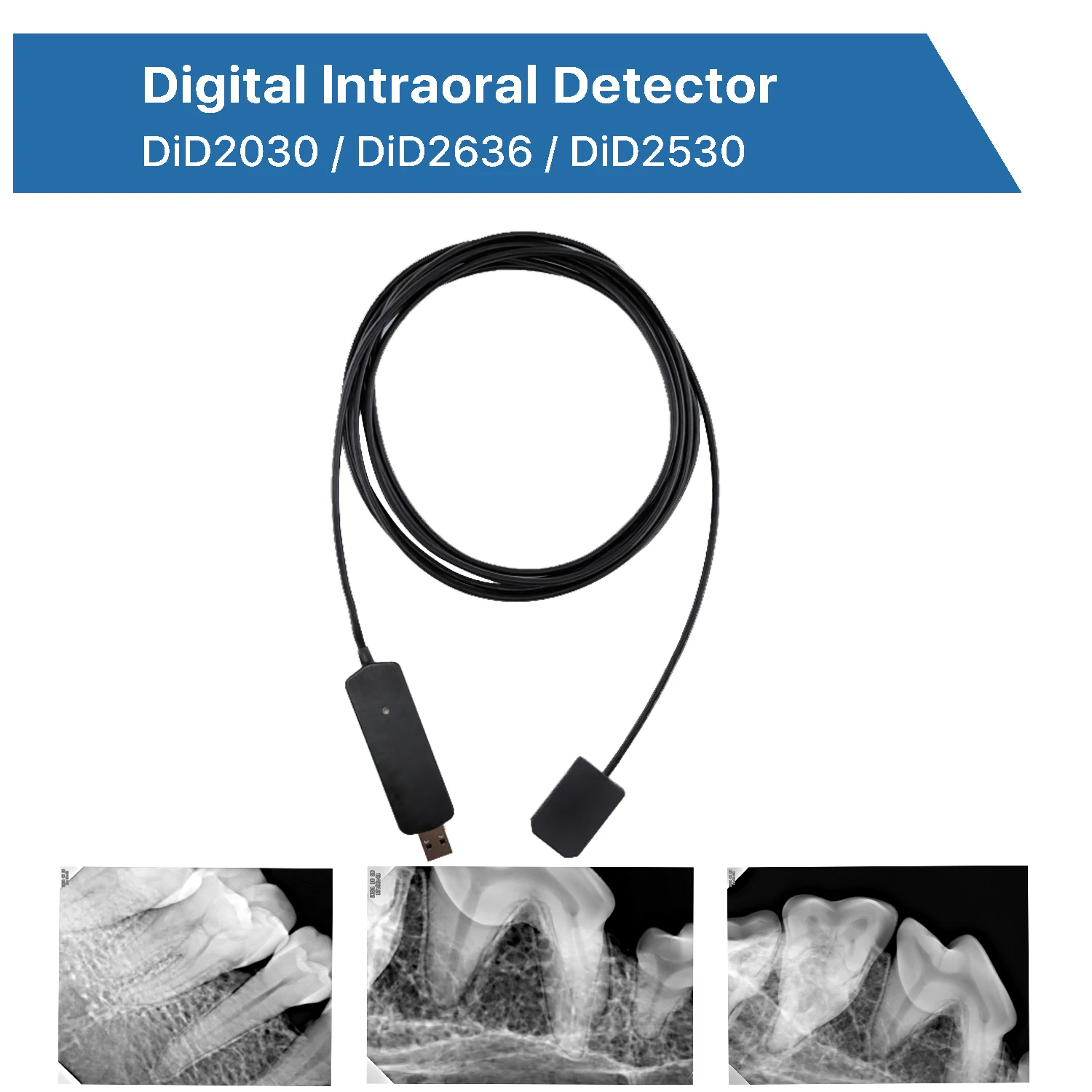 

Портативный цифровой рентгеновский детектор (RVG) для стоматологии: HD-камера для получения изображений при имплантации и хирургии
