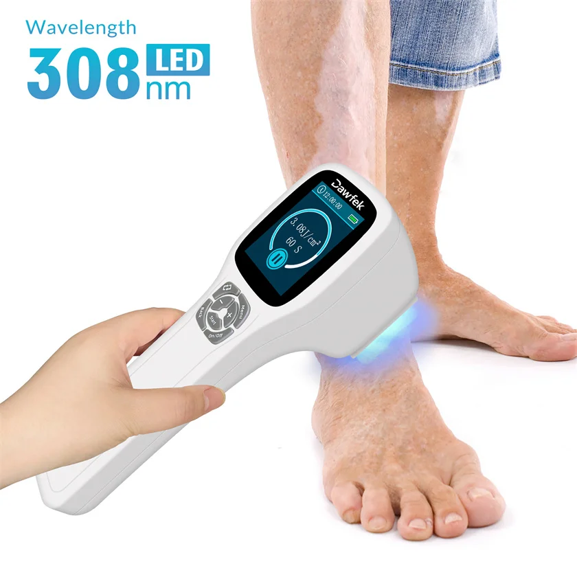 

Medical Treatment Device 308nm Excimer Blue Light Therapy UVB Light Treating Eczema Vitiligo Psoriasis Skin Diseases Home Use