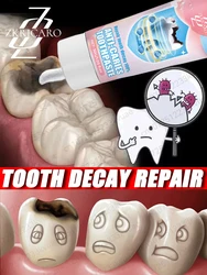 Anti-Cavity Toothpaste Tooth Remineralization Recovery Enamel Repair Strengthening Restoration Decay Protection Dental Teeth