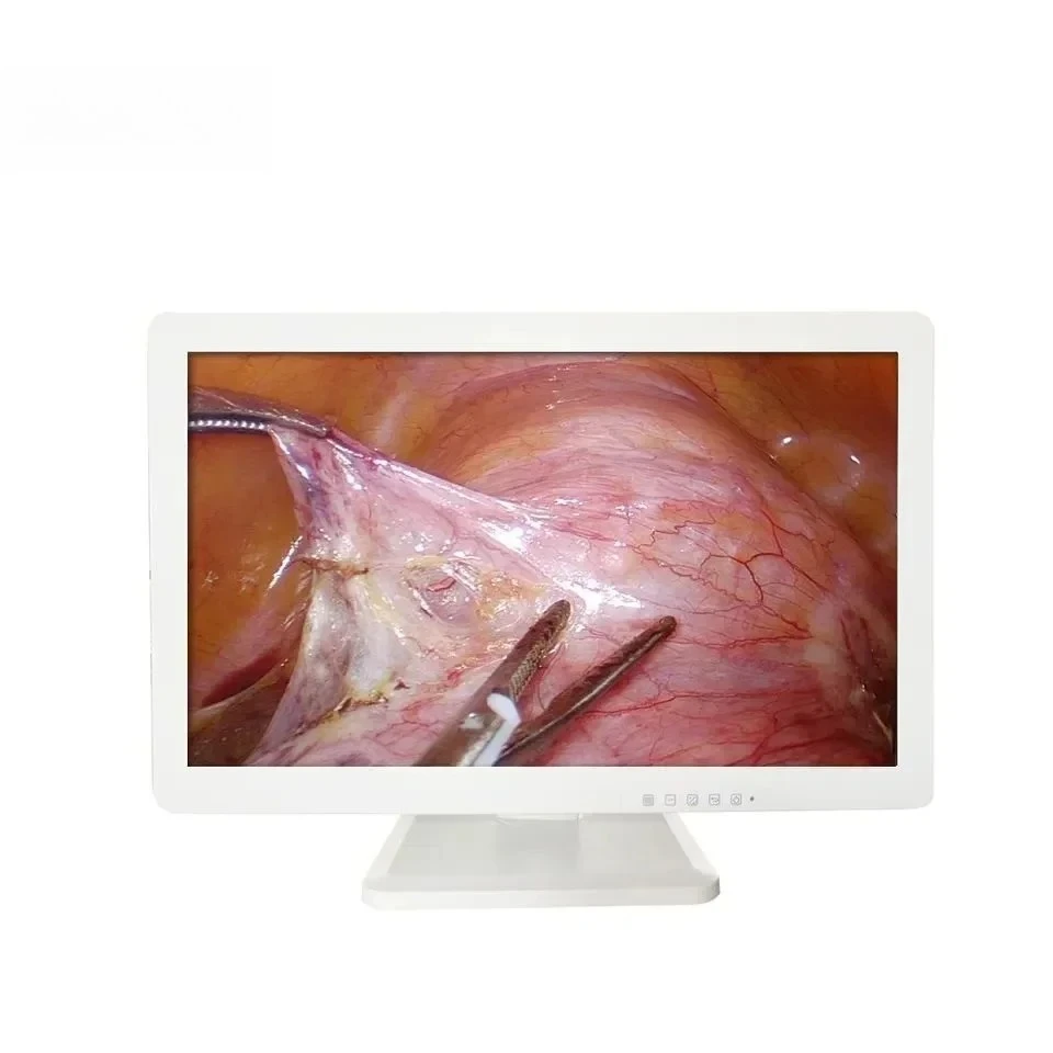 

Top Quality Endoscope Medical Equipment for surgical picture display Pc