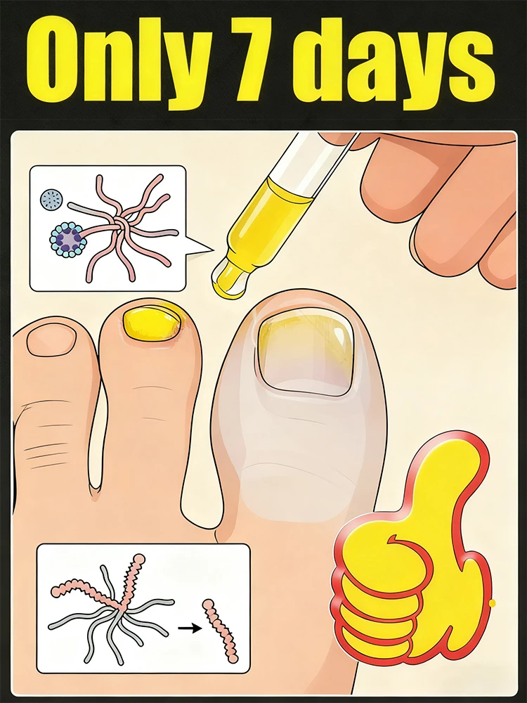 Fast penetration, nails become translucent and fungal free.