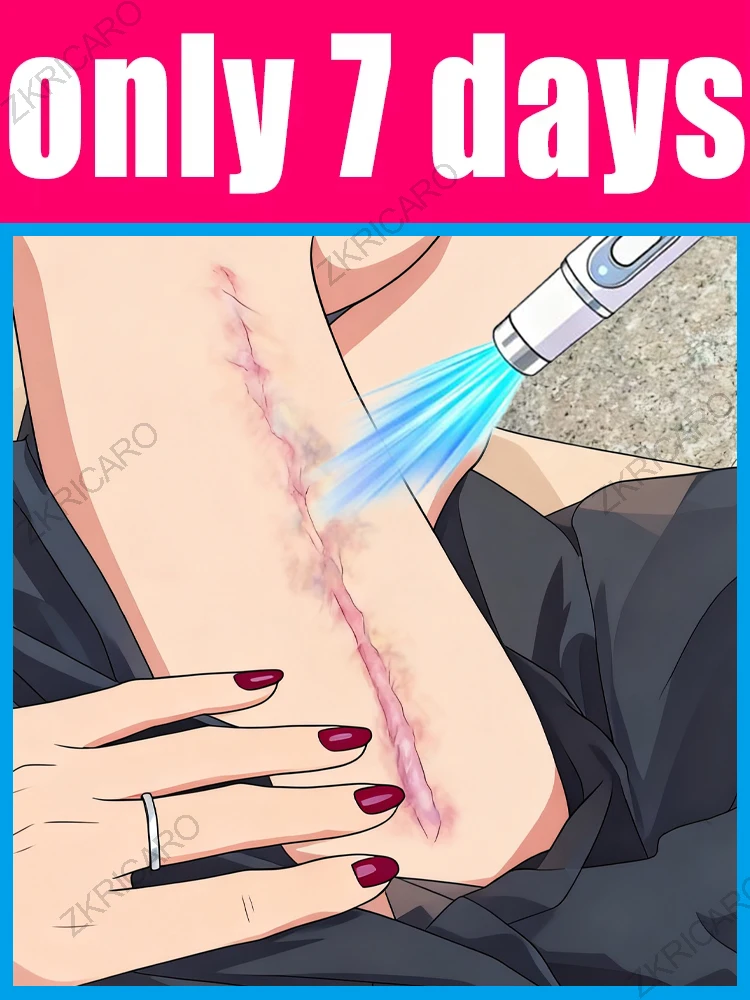 

Технологические изменения жизни и прощаются шрамы!