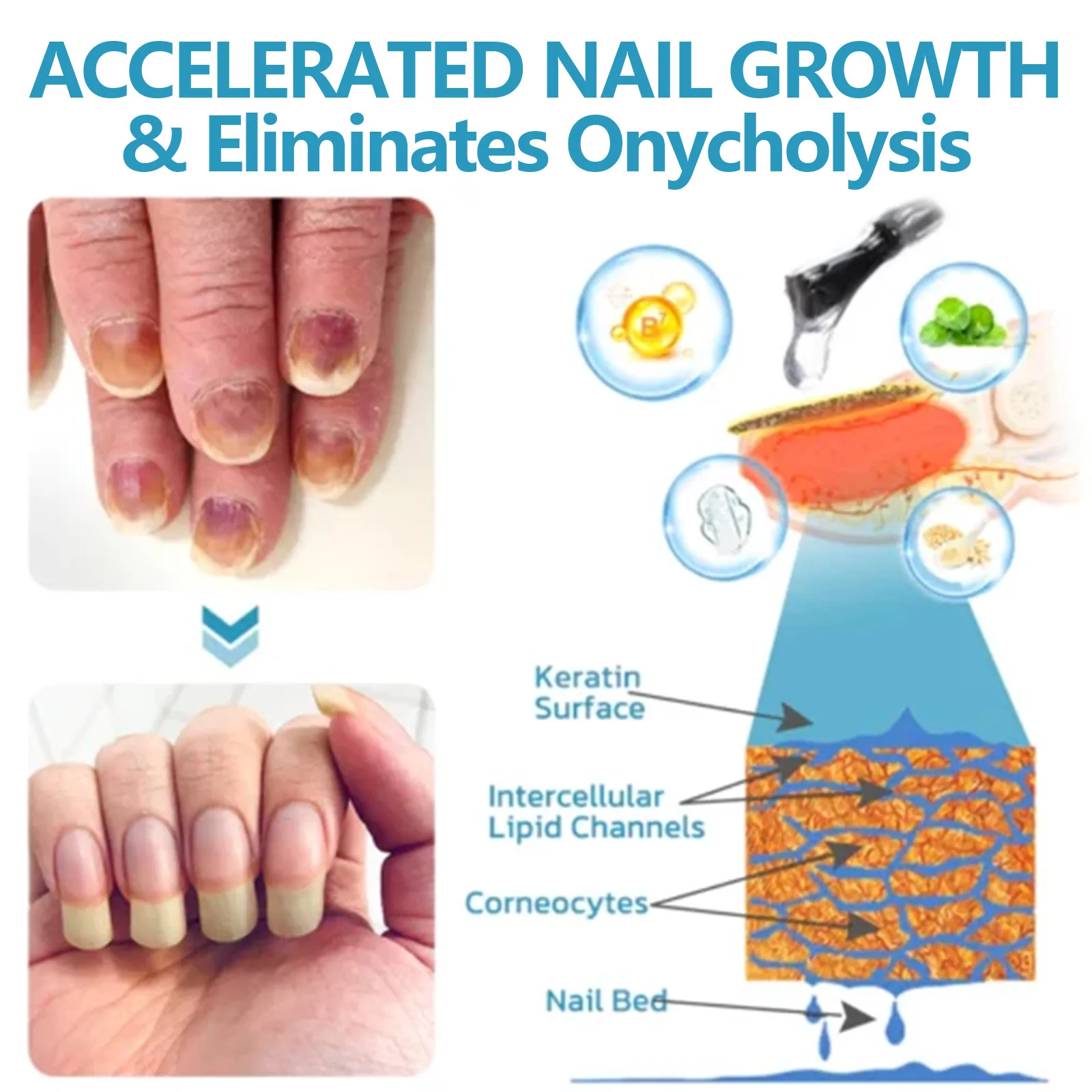 Nail Care Serum Remove Cuticle Repair Damaged Nail Improve Onychomycosis Moisturizing Soften Strengthen Nails Repairing Essence