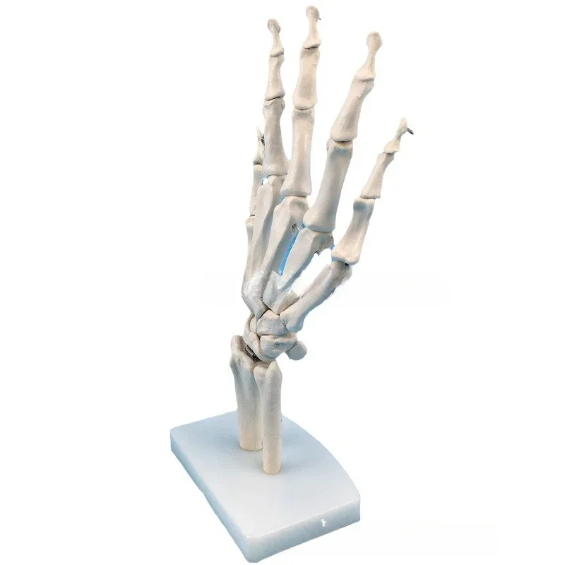 Рисунок 2 - Медицинская модель сустава руки человека