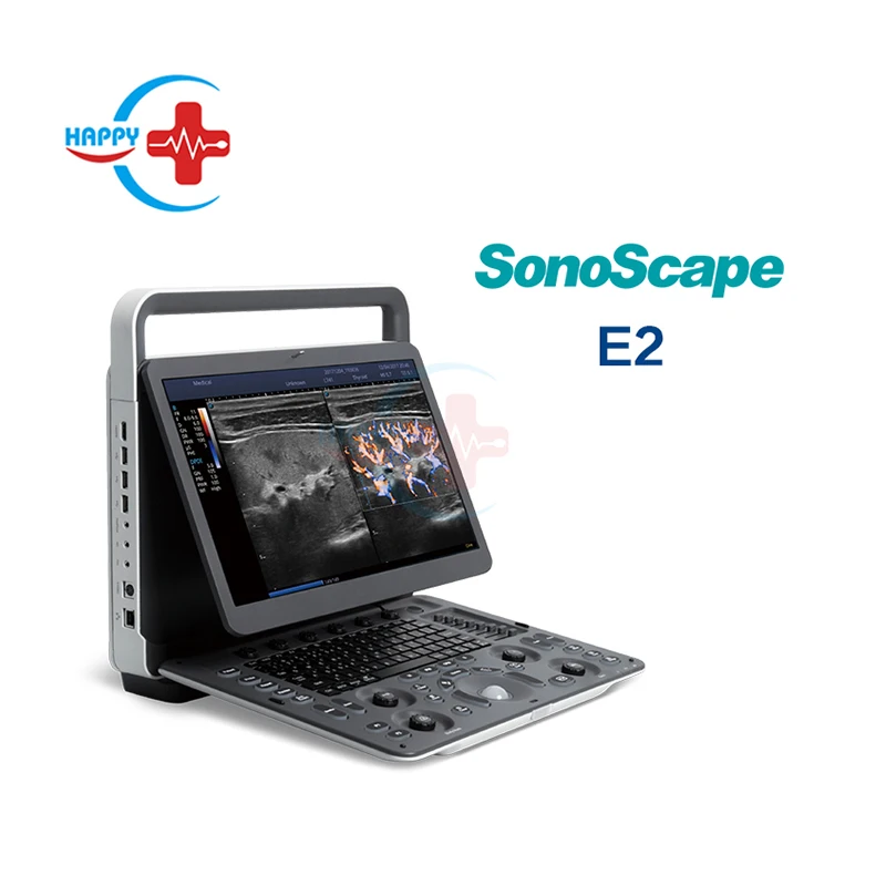 Hospital use Sonoscape E2 Ultrasound 15inch laptop Digital Color Doppler with convex probe Ultrasound scanner