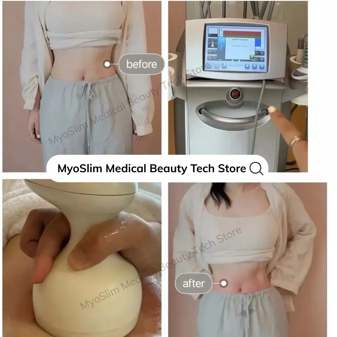 

Профессиональный аппарат Venus Legacy для коррекции фигуры, уменьшения целлюлита, устранения морщин, вакуумного удаления жира, отбеливания кожи и радиочастотного похудения