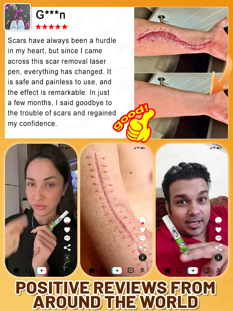 2025 latest laser pen, repair various scars