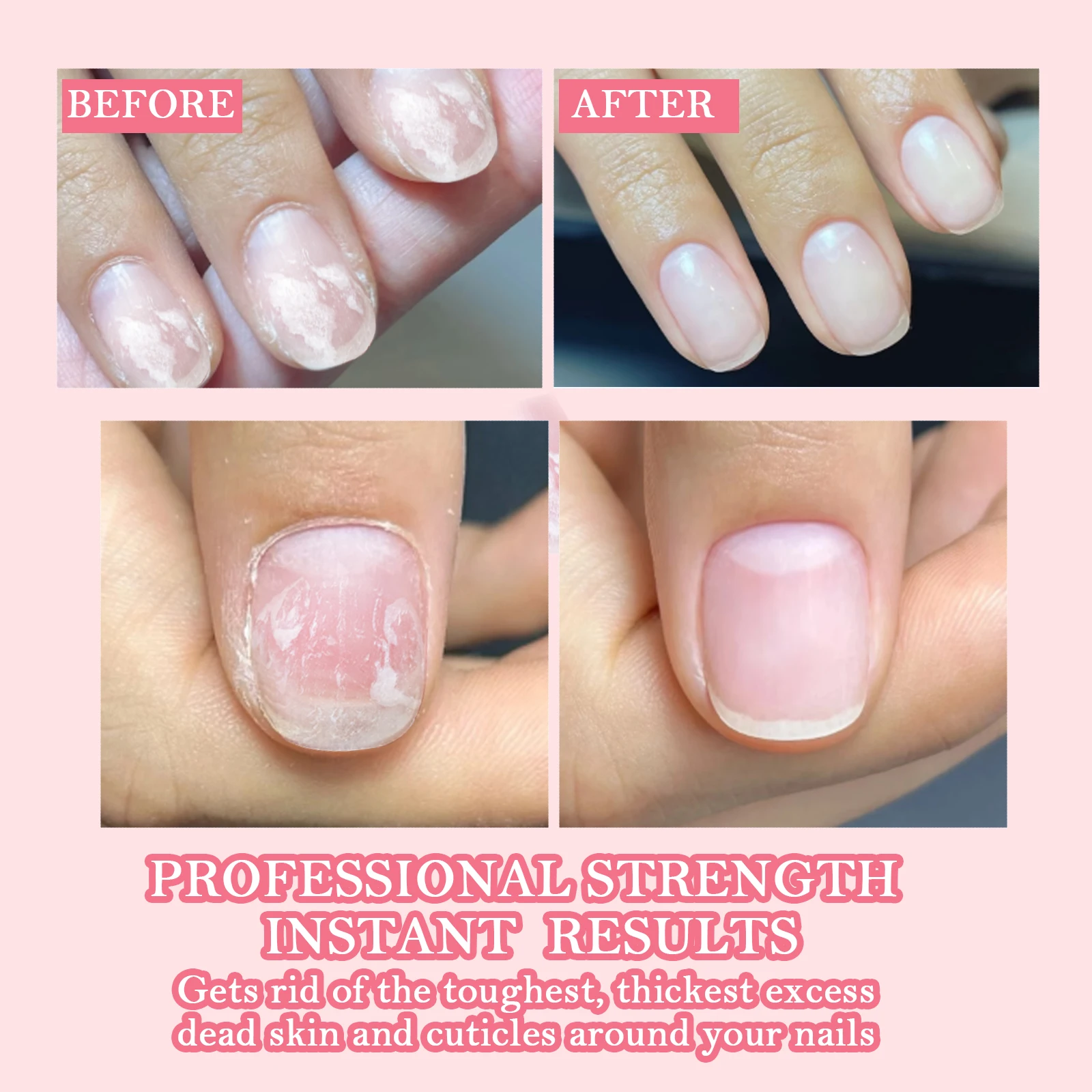 น้ำยาบำรุงเล็บ, น้ำยาทาเล็บสีชมพูแบบแห้งเร็ว น้ำยาบำรุงเล็บเพื่อการเจริญเติบโต น้ำยาบำรุงเล็บสำหรับเล็บบางและเพื่อการเจริญเติบโต