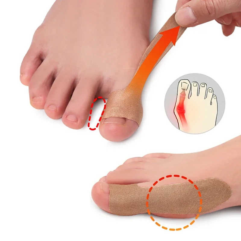 5 Sheets Non-woven Fabric Toe Separator Patches Bunion Hallux Valgus Corrector Thumb Correction for Foot Care