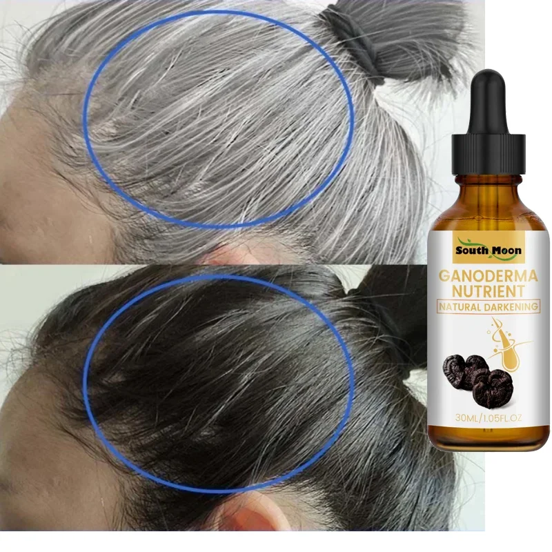 Gray White Hair Treatment Serum Oil White To Black Permanent Treatment Natural Color Repair Anti Loss Product Care For Men Women