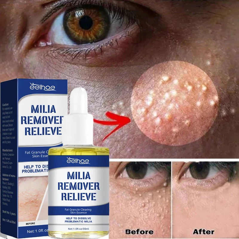 Fat Granules Removal Eye Serum Anti Dark Circle Eye Bags Fade Fine Line Essence Anti-Puffiness Moisturizing Skin Care Products