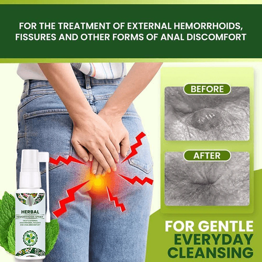 natural herbal spray mixed with Anshu spray relieve swelling hemorrhoid eliminate meat ball hemorrhoid spray 30ml