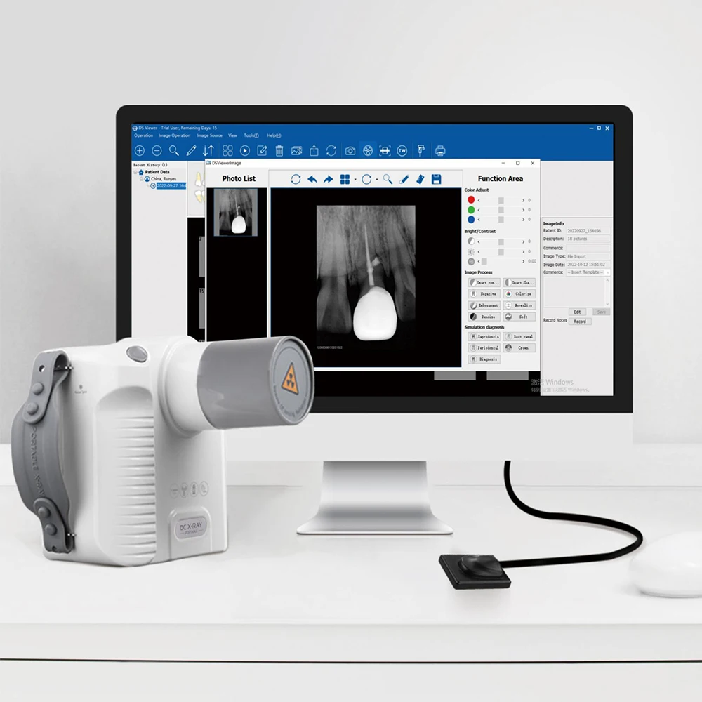 Dental Portable X-Ray Digital Sensor Intraoral X Ray Sensor Less Radiation Imaging System Dentistry Clinic Instrument