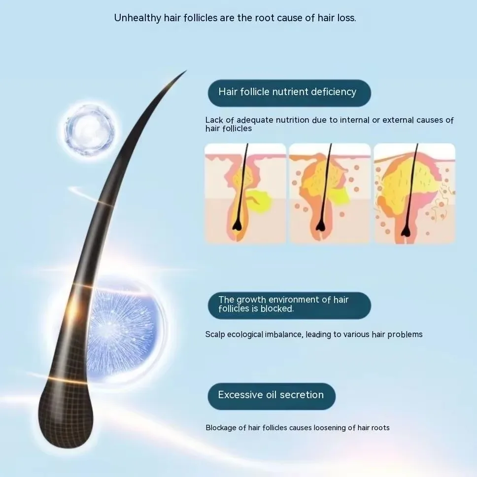 EHD Anti-Growth Hair Growth Shampoo Nourishing Soothing Hair Follicles Soft Fluffy Repair Root Promote Strengthen Hair Care500ml