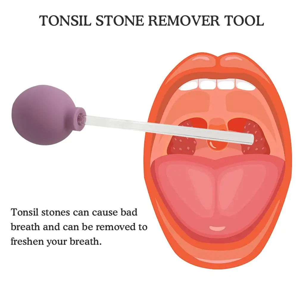 1pcs Tonsil Stone Remover Tool Manual Style Mouth Cleaning Ear Cleaner Colour Ball Random Care Suction Wax S0V4