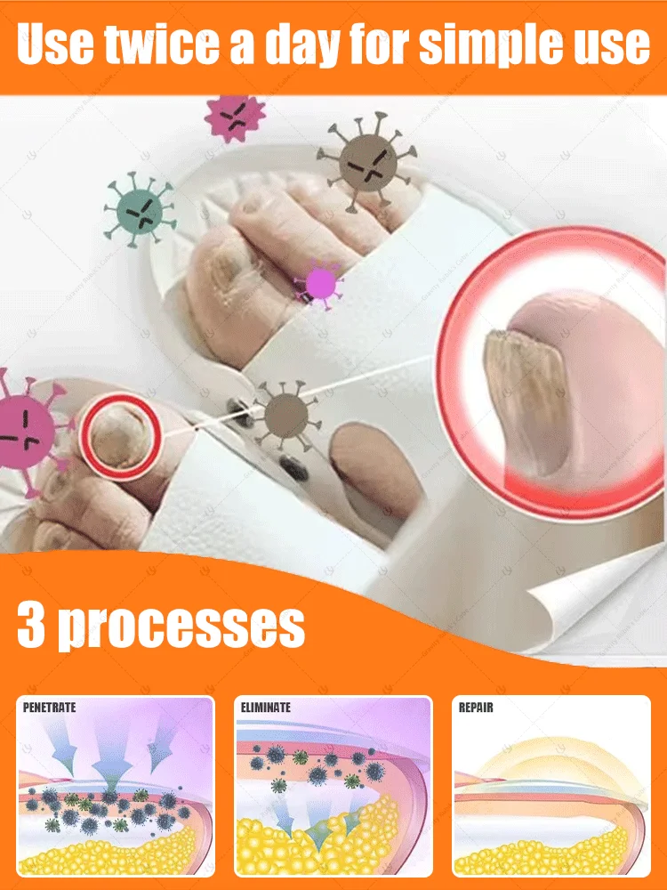 Nagelreinigingshulpmiddel, nail art stickers, vaarwel nagelproblemen