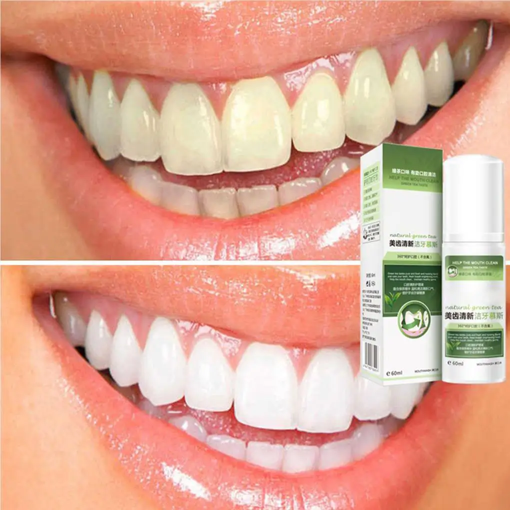 60ml Teeth Cleaning Mousse Fresh Breath Remove Tooth Stain Teeth Whitening Oral Cleaning Care