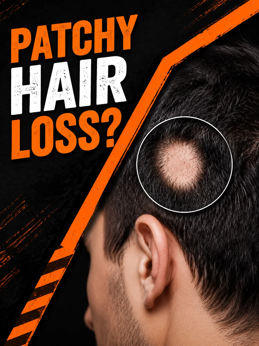 Hair Growth Serum with Roller Scalp Applicator Massages Scalp Promotes Fast Growth Strengthens Roots Hair Care